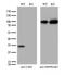 U6 snRNA phosphodiesterase antibody, M07652, Boster Biological Technology, Western Blot image 