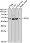 Epoxide Hydrolase 1 antibody, GTX55606, GeneTex, Western Blot image 