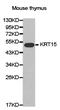 Keratin 15 antibody, A06791-2, Boster Biological Technology, Western Blot image 