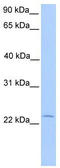 Annexin A2 Receptor antibody, TA334944, Origene, Western Blot image 