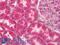 NUMB Endocytic Adaptor Protein antibody, LS-C784926, Lifespan Biosciences, Immunohistochemistry paraffin image 