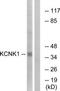 TWIK1 antibody, TA314134, Origene, Western Blot image 