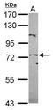 hPot1 antibody, GTX119700, GeneTex, Western Blot image 