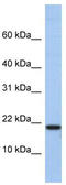 Nuclear nucleic acid-binding protein C1D antibody, TA339698, Origene, Western Blot image 