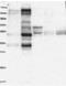 Pleckstrin Homology Like Domain Family B Member 1 antibody, NBP1-90450, Novus Biologicals, Western Blot image 