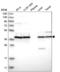 Uroporphyrinogen decarboxylase antibody, NBP2-57511, Novus Biologicals, Western Blot image 