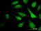 Trinucleotide Repeat Containing Adaptor 6C antibody, H00057690-M08, Novus Biologicals, Immunocytochemistry image 