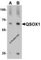 Quiescin Sulfhydryl Oxidase 1 antibody, 8171, ProSci, Western Blot image 