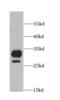Catechol O-methyltransferase antibody, FNab01856, FineTest, Western Blot image 