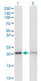 Ribosomal Protein S5 antibody, LS-C139301, Lifespan Biosciences, Western Blot image 