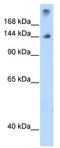 SF3b155 antibody, TA345713, Origene, Western Blot image 