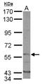 Dual specificity tyrosine-phosphorylation-regulated kinase 1B antibody, NBP1-33464, Novus Biologicals, Western Blot image 