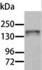Ro antibody, LS-C401212, Lifespan Biosciences, Western Blot image 