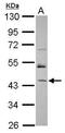 RNA Binding Motif Protein 17 antibody, GTX120047, GeneTex, Western Blot image 