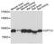 Carnitine O-palmitoyltransferase 1, brain isoform antibody, A13849, ABclonal Technology, Western Blot image 
