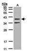 Galanin Receptor 2 antibody, orb73591, Biorbyt, Western Blot image 