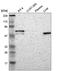 F-Box Protein 3 antibody, HPA002467, Atlas Antibodies, Western Blot image 