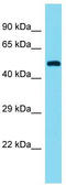 Elongation Factor For RNA Polymerase II 3 antibody, TA343230, Origene, Western Blot image 