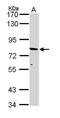 ATP Binding Cassette Subfamily D Member 2 antibody, TA308846, Origene, Western Blot image 