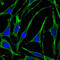 PTH1R antibody, abx011776, Abbexa, Enzyme Linked Immunosorbent Assay image 