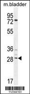 Proline-rich protein BCA3 antibody, 55-034, ProSci, Western Blot image 