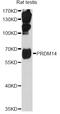 PR/SET Domain 14 antibody, STJ27532, St John
