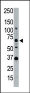 SUMO Specific Peptidase 1 antibody, AP11232PU-N, Origene, Western Blot image 