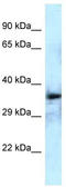 DEP Domain Containing MTOR Interacting Protein antibody, TA343212, Origene, Western Blot image 