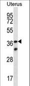 Olfactory Receptor Family 4 Subfamily X Member 2 (Gene/Pseudogene) antibody, LS-C158478, Lifespan Biosciences, Western Blot image 