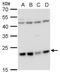 Leucine Zipper And CTNNBIP1 Domain Containing antibody, PA5-35917, Invitrogen Antibodies, Western Blot image 
