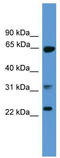 Clathrin Light Chain A antibody, TA342619, Origene, Western Blot image 