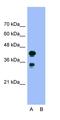 TAR DNA Binding Protein antibody, orb330029, Biorbyt, Western Blot image 
