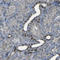 Stromal Interaction Molecule 1 antibody, HPA011088, Atlas Antibodies, Immunohistochemistry paraffin image 