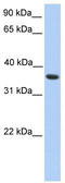 Melanoma-associated antigen 4 antibody, TA334932, Origene, Western Blot image 