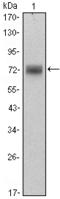 Zinc Finger And BTB Domain Containing 16 antibody, M00817, Boster Biological Technology, Western Blot image 