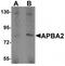 Amyloid Beta Precursor Protein Binding Family A Member 2 antibody, TA319614, Origene, Western Blot image 
