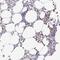 Melanoma-associated antigen C3 antibody, NBP2-14757, Novus Biologicals, Immunohistochemistry frozen image 