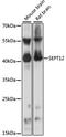 Septin 12 antibody, LS-C750530, Lifespan Biosciences, Western Blot image 