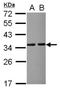B36-VDAC antibody, NBP2-20850, Novus Biologicals, Western Blot image 