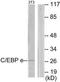 CCAAT Enhancer Binding Protein Epsilon antibody, TA313612, Origene, Western Blot image 