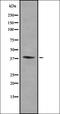 Killer cell immunoglobulin-like receptor 2DL5B antibody, orb378254, Biorbyt, Western Blot image 
