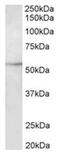 Tubulin Beta 3 Class III antibody, AP32033PU-N, Origene, Western Blot image 
