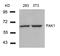 P21 (RAC1) Activated Kinase 1 antibody, A00454, Boster Biological Technology, Western Blot image 