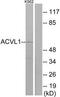 Activin A Receptor Like Type 1 antibody, TA311718, Origene, Western Blot image 