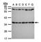 Ribosomal Protein S3A antibody, TA308427, Origene, Western Blot image 