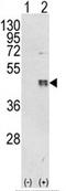 CCAAT Enhancer Binding Protein Beta antibody, AP17939PU-N, Origene, Western Blot image 
