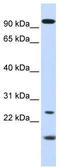 Guanylate Cyclase Activator 1A antibody, TA336234, Origene, Western Blot image 
