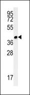 Coiled-coil domain-containing protein 106 antibody, MBS9206331, MyBioSource, Western Blot image 