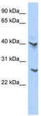 ATPase H+ Transporting V1 Subunit E2 antibody, TA339996, Origene, Western Blot image 