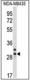 Chymotrypsin Like Elastase 2A antibody, AP32364PU-N, Origene, Western Blot image 